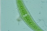 Closterium moniliferum