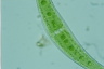 Closterium moniliferum