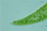 Closterium ehrenbergii