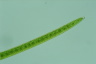 Closterium acerosum