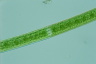 Closterium acerosum