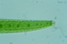 Closterium turgidum