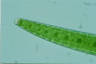 Closterium turgidum