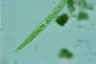 Closterium cornu