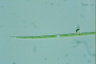 Closterium idiosporum