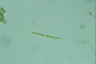 Closterium idiosporum