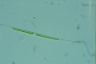 Closterium idiosporum