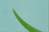 Closterium nematodes