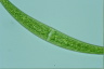 Closterium nematodes