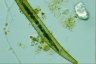 Closterium costatum