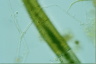 Closterium costatum