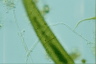 Closterium costatum