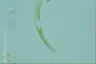 Closterium dianae