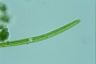 Closterium toxon