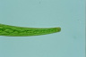 Closterium intermedium