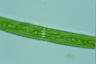 Closterium intermedium