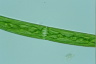 Closterium intermedium