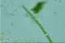 Closterium toxon