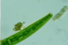 Closterium baillyanum