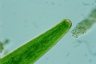 Closterium baillyanum