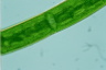 Closterium baillyanum