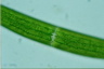 Closterium baillyanum