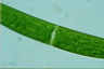 Closterium baillyanum