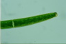 Closterium baillyanum