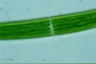 Closterium baillyanum