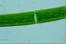 Closterium baillyanum