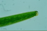 Closterium baillyanum