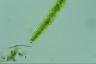 Closterium baillyanum