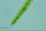 Closterium baillyanum