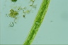 Closterium baillyanum