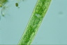 Closterium baillyanum