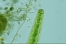 Closterium baillyanum