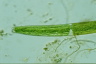 Closterium baillyanum