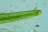 Closterium baillyanum