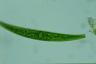 Closterium striolatum