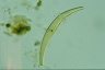 Closterium rostratum