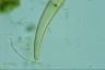 Closterium rostratum