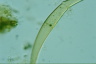 Closterium rostratum