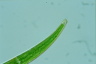 Closterium rostratum