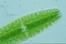 Netrium digitus