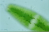 Netrium digitus