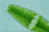 Netrium digitus