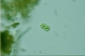 Cylindrocystis brebissonii