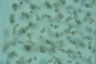 Microcystis