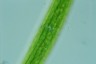 Closterium baillyanum