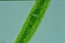 Closterium baillyanum